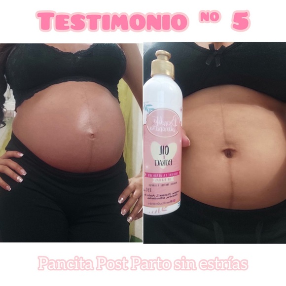 Meet your Posher, MB Distributor, LLC - Picture 11 of 17